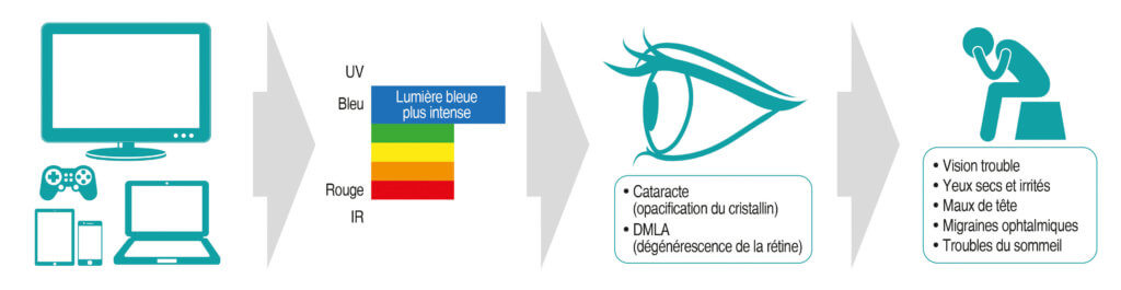 Les dangers de la lumière bleue sur nos yeux.